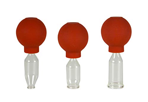 Lauschaer Glas 3er Schröpfglas-Set mit Ball 10-15-20mm zum professionellen, medizinischen, feuerlosen Schröpfen mundgeblasen, handgeformt, Schröpfglas, Schröpfgläser, Lauschaer Glas das Original