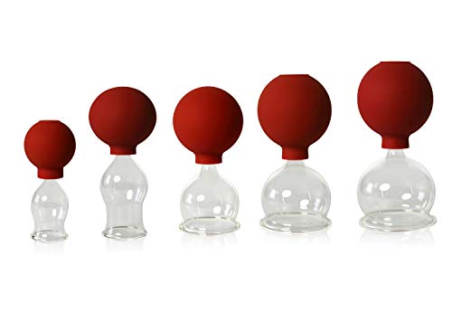 5er Schröpfglas-Set mit Ball 25-35-45-55-60mm zum professionellen, medizinischen, feuerlosen Schröpfen, Schröpfglas, Schröpfgläser, Lauschaer Glas das Original