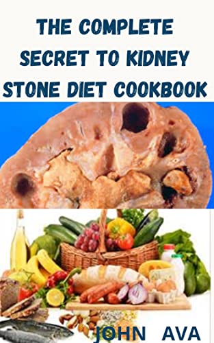 THE COMPLETE SECRET TO KIDNEY STONE DIET COOKBOOK (English Edition)